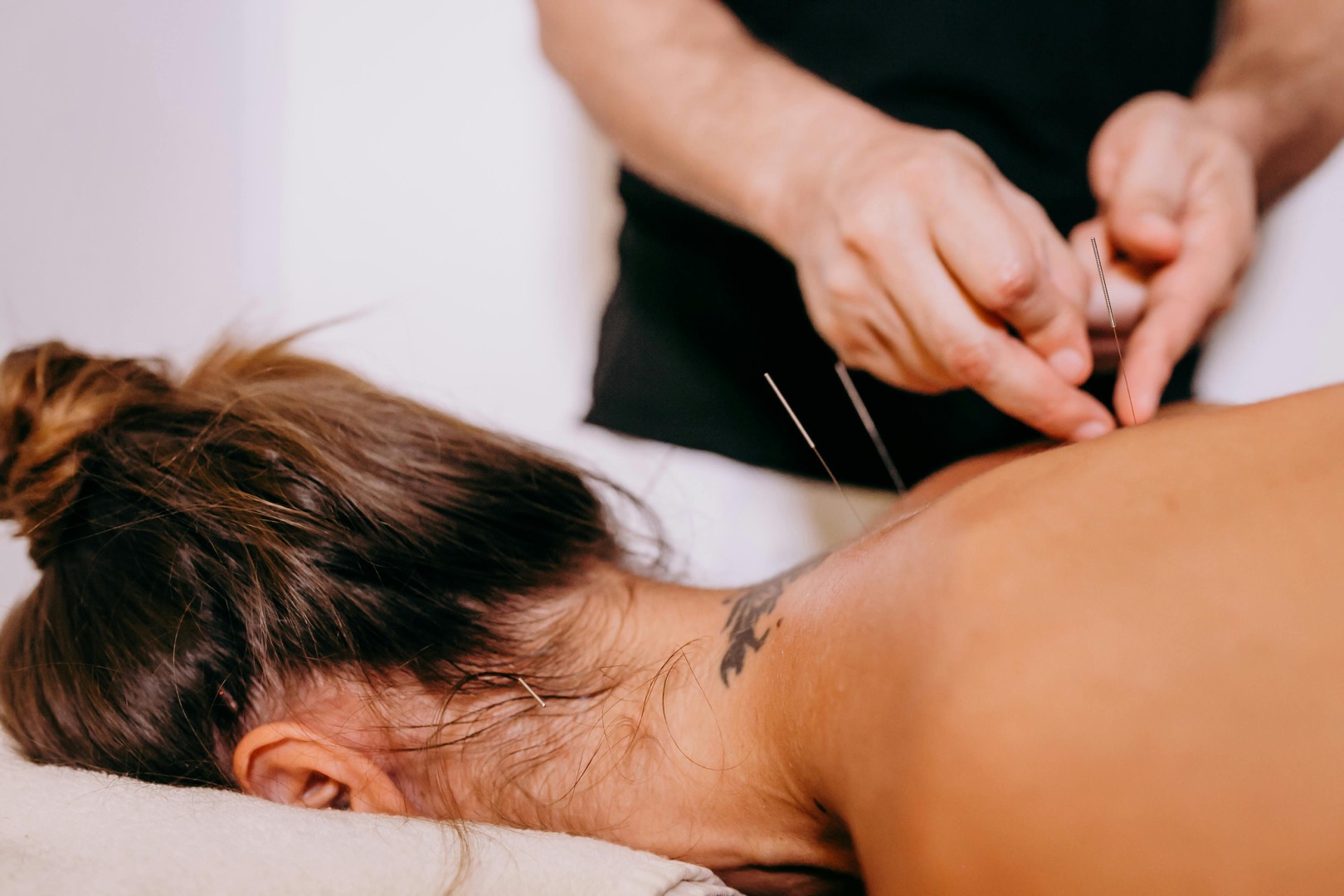 Dry needling treatment at Black Sheep Physical Therapy — needles placed in patient's upper back and neck muscles